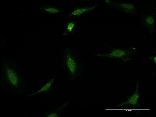 CDR2 Antibody in Immunocytochemistry (ICC/IF)