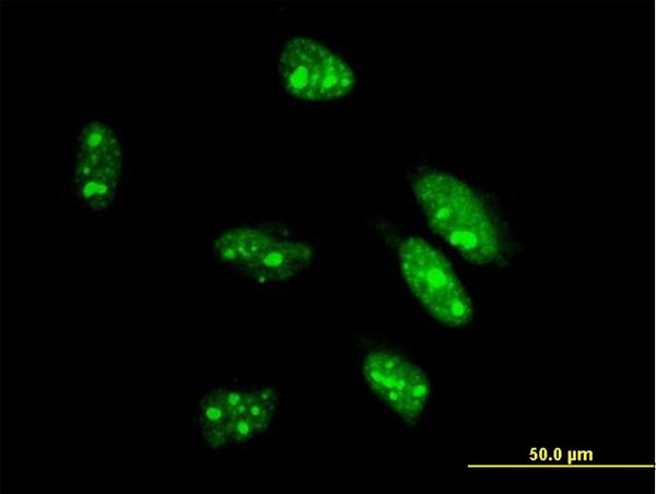 CDX1 Antibody in Immunocytochemistry (ICC/IF)