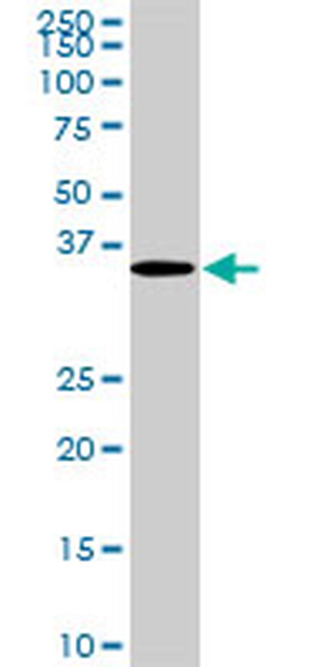 CDX4 Antibody in Western Blot (WB)