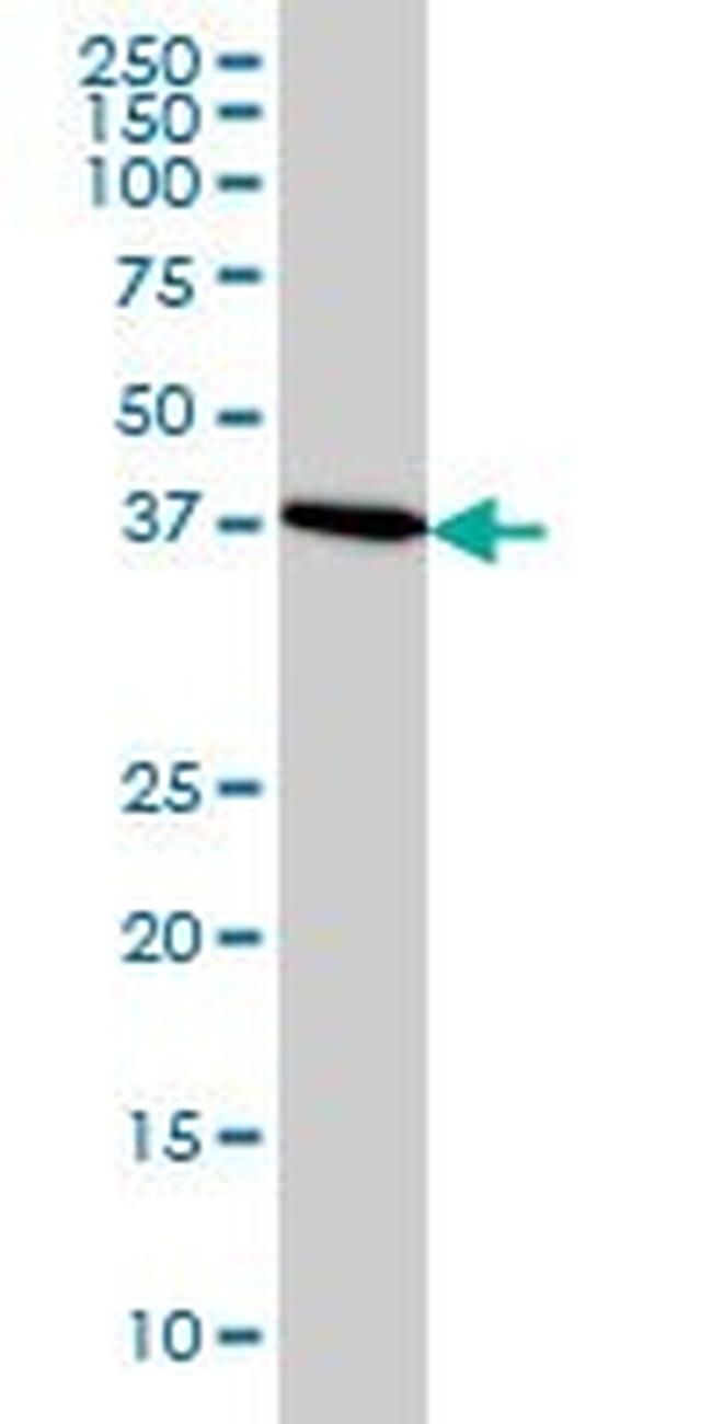 CDX4 Antibody in Western Blot (WB)