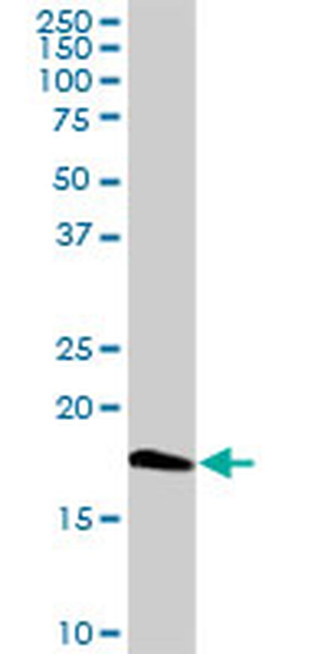 CETN1 Antibody in Western Blot (WB)