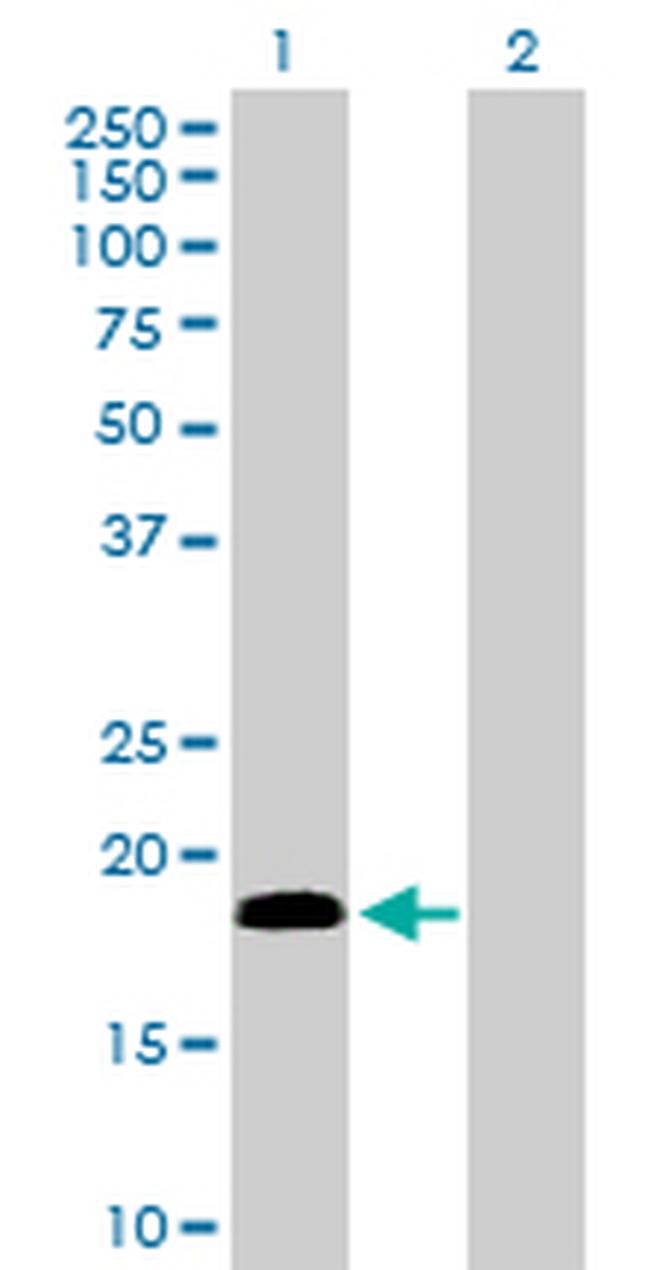 CETN1 Antibody in Western Blot (WB)