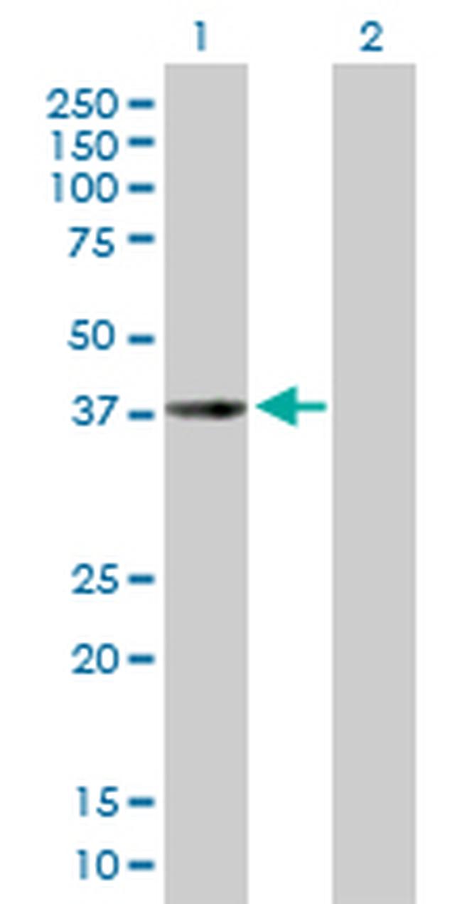 CHI3L2 Antibody in Western Blot (WB)