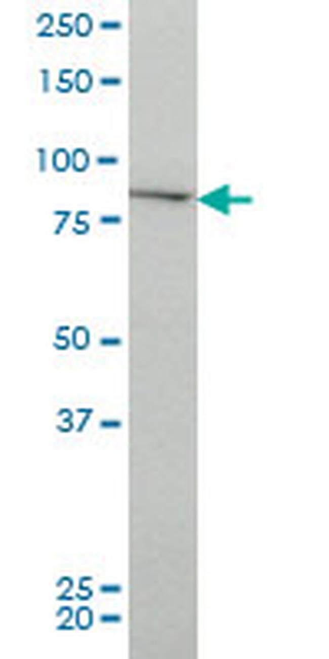 CHUK Antibody in Western Blot (WB)