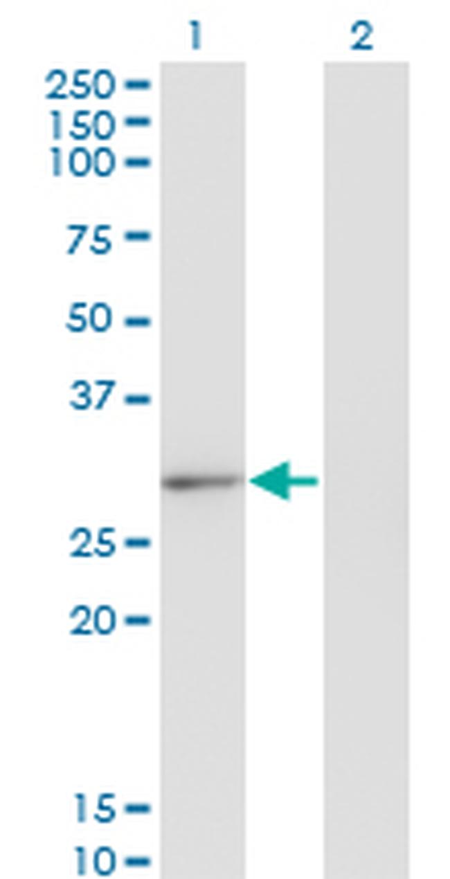 CLIC2 Antibody in Western Blot (WB)