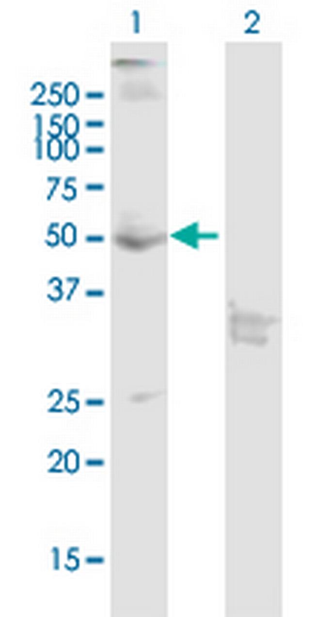 CNR1 Antibody in Western Blot (WB)