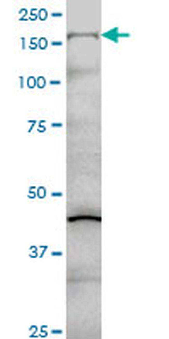 COL5A1 Antibody in Western Blot (WB)