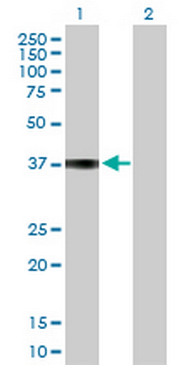 COL9A1 Antibody in Western Blot (WB)