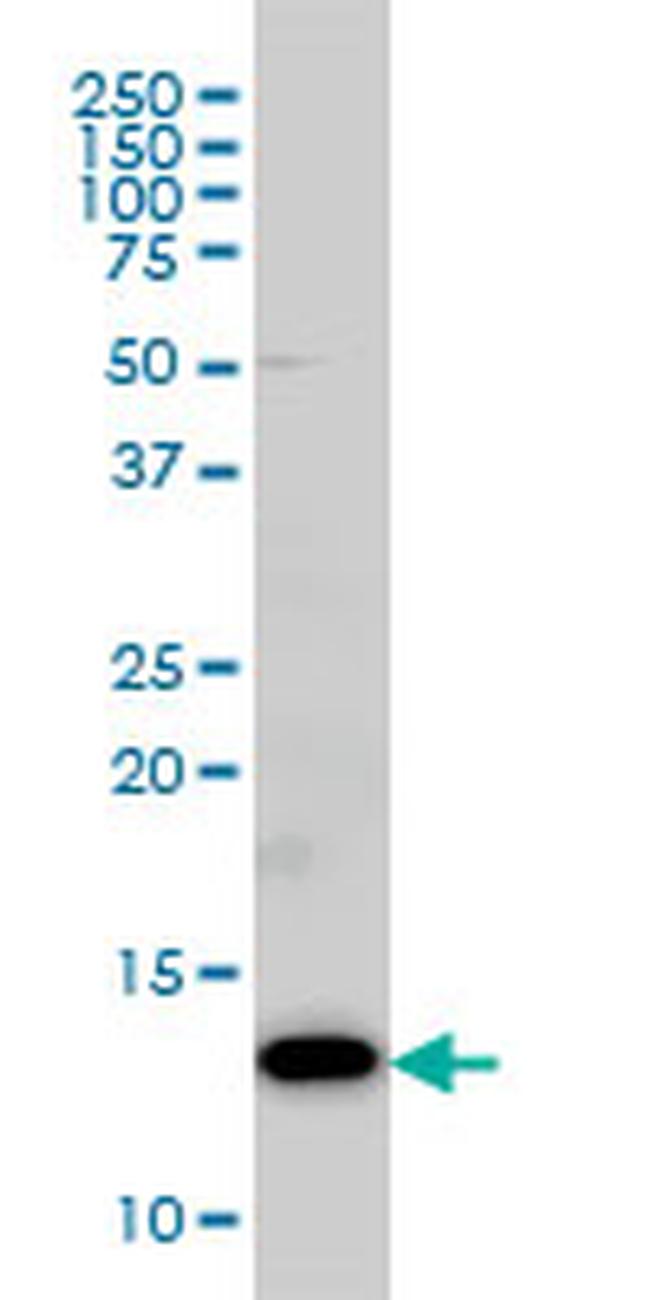 COX5B Antibody in Western Blot (WB)