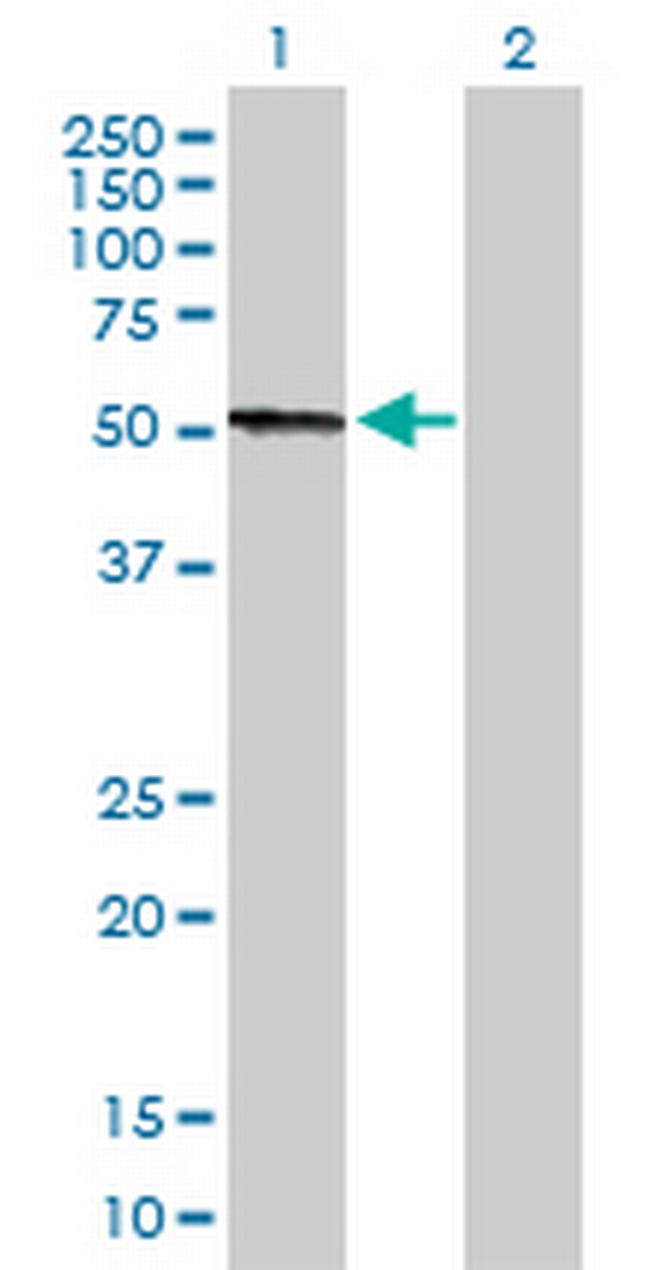 CPB2 Antibody in Western Blot (WB)