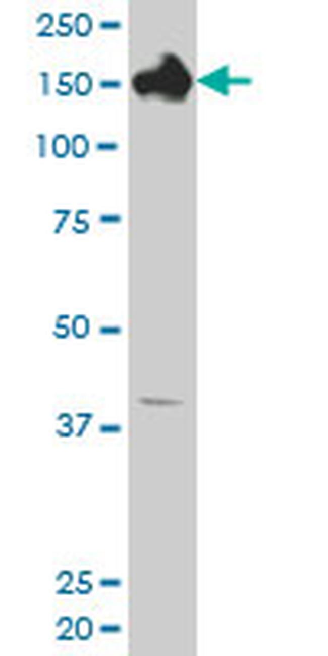 CPS1 Antibody in Western Blot (WB)