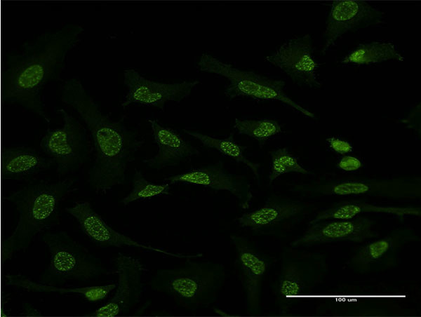 ATF2 Antibody in Immunocytochemistry (ICC/IF)