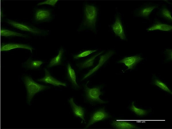 CRY2 Antibody in Immunocytochemistry (ICC/IF)