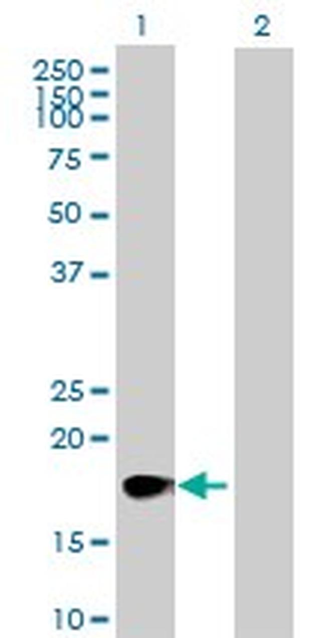 CSF2 Antibody in Western Blot (WB)