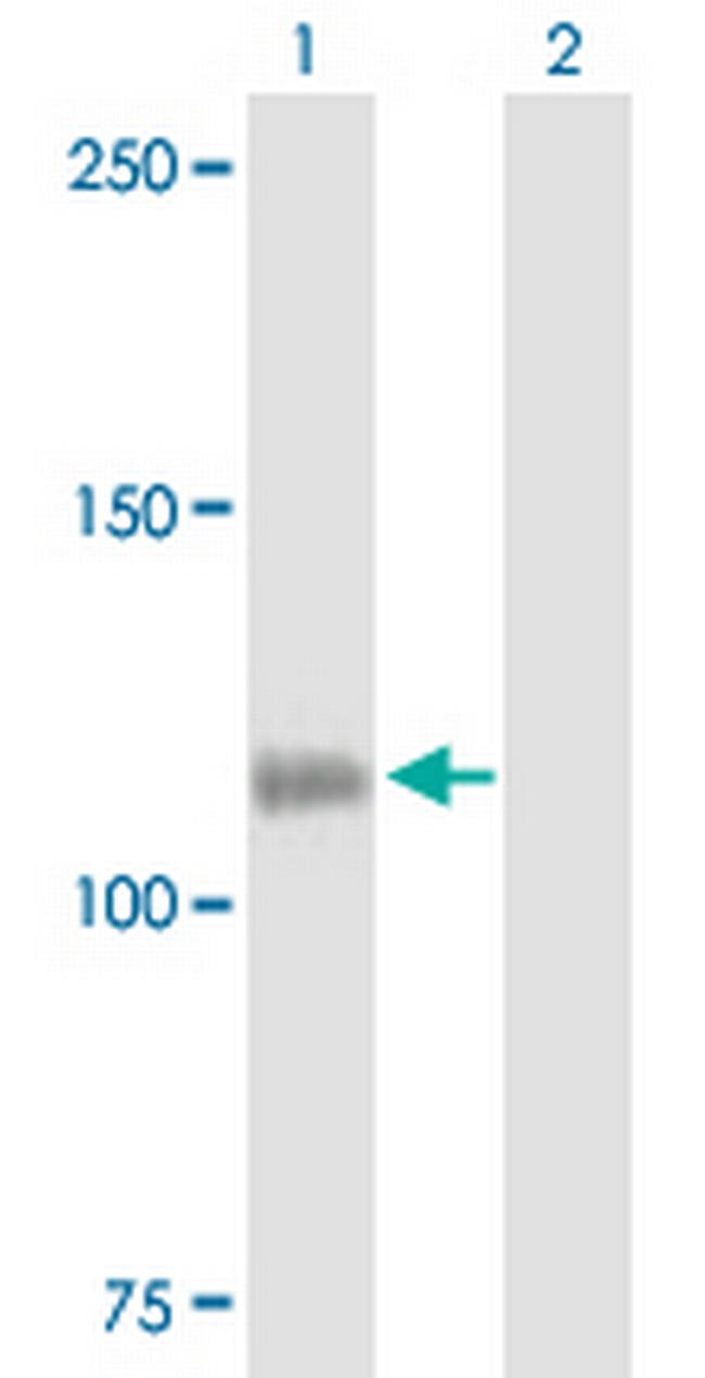 CSF2RB Antibody in Western Blot (WB)