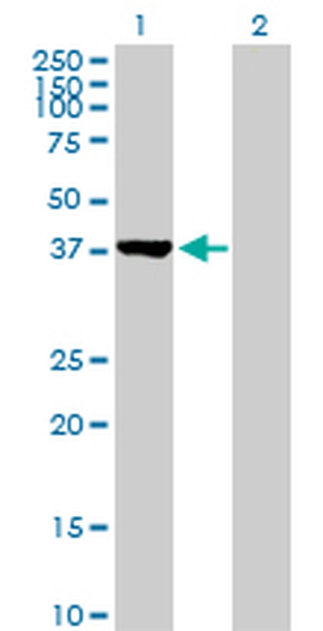 CTH Antibody in Western Blot (WB)