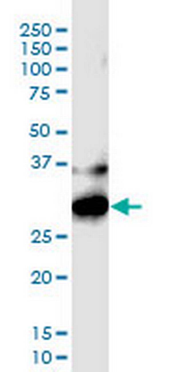 CTLA4 Antibody in Western Blot (WB)