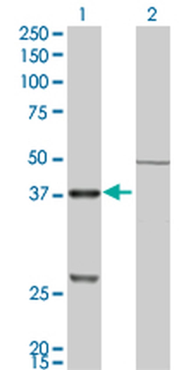 CTSK Antibody in Western Blot (WB)