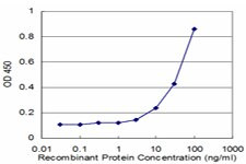 CTSK Antibody in ELISA (ELISA)