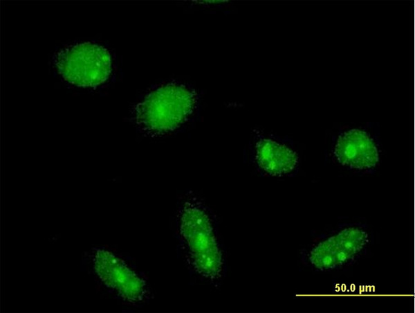 CYLD Antibody in Immunocytochemistry (ICC/IF)