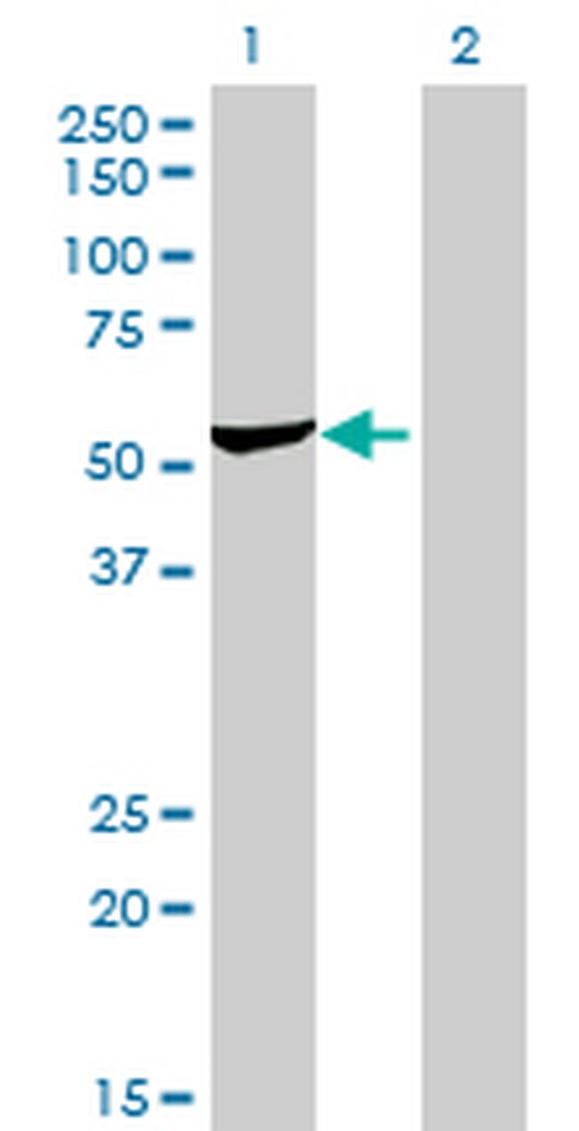 DARS Antibody in Western Blot (WB)