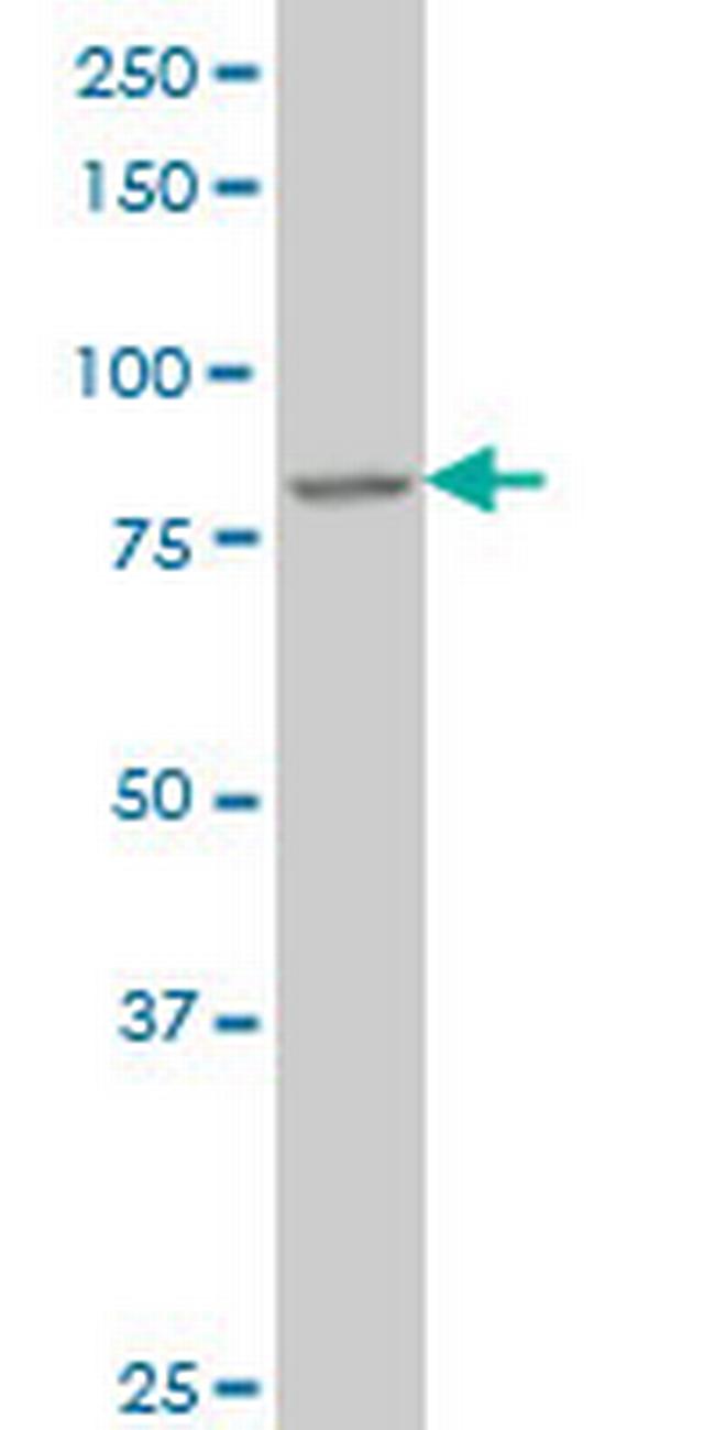 DAZ1 Antibody in Western Blot (WB)