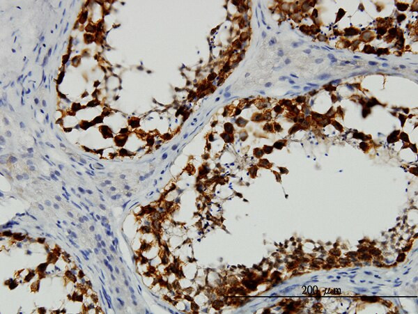 DAZ1 Antibody in Immunohistochemistry (Paraffin) (IHC (P))