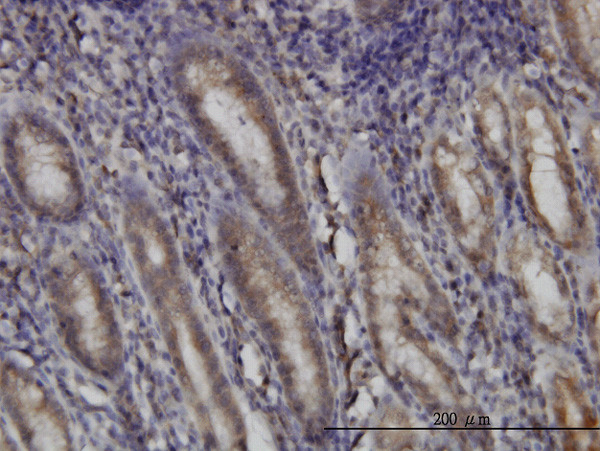 DHODH Antibody in Immunohistochemistry (Paraffin) (IHC (P))