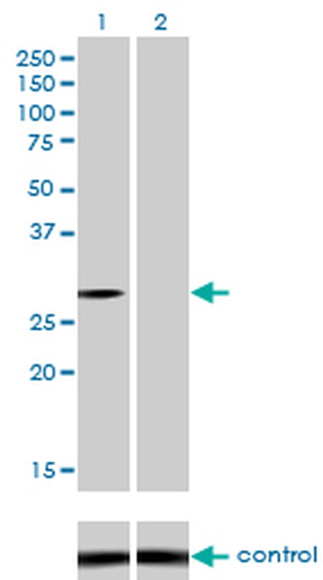 NQO1 Antibody in Western Blot (WB)