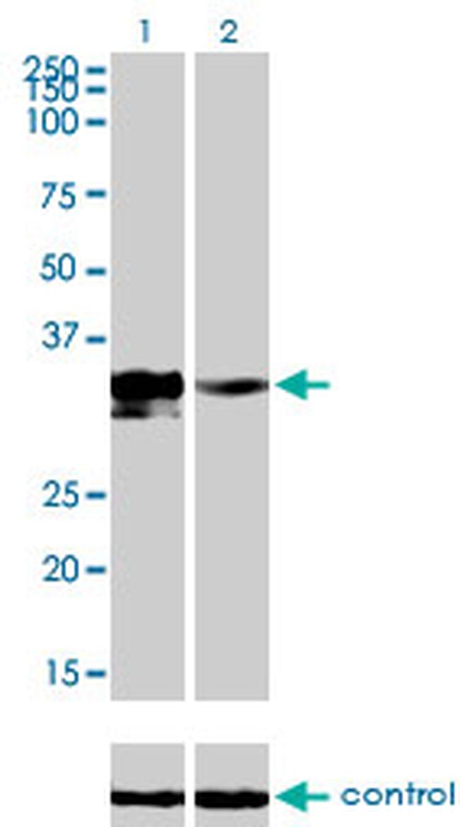 DLX3 Antibody in Western Blot (WB)