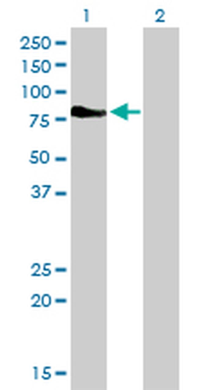 DMPK Antibody in Western Blot (WB)