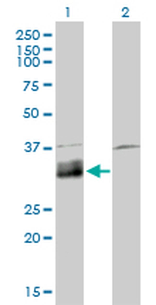 DNASE1L1 Antibody in Western Blot (WB)