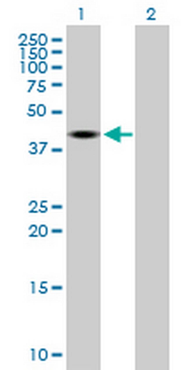 TRDMT1 Antibody in Western Blot (WB)