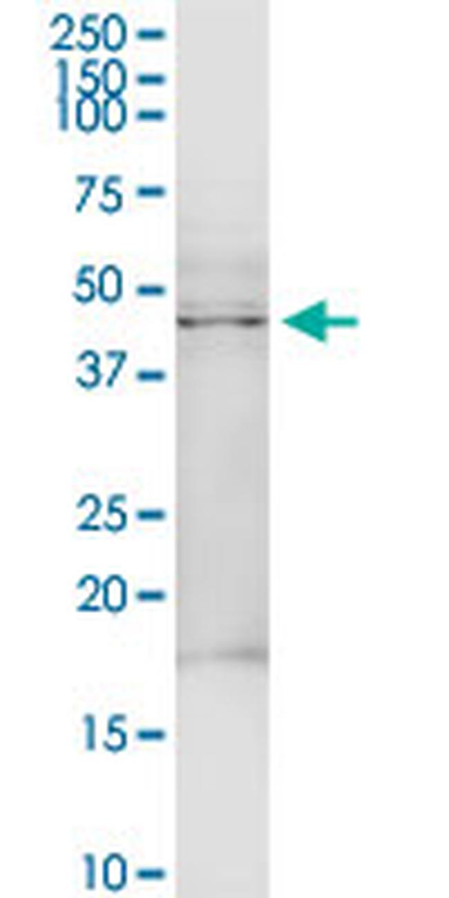 TRDMT1 Antibody in Western Blot (WB)