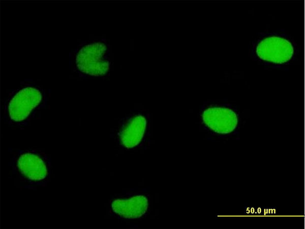 DUT Antibody in Immunocytochemistry (ICC/IF)