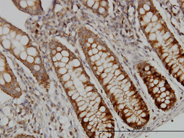 DUT Antibody in Immunohistochemistry (Paraffin) (IHC (P))