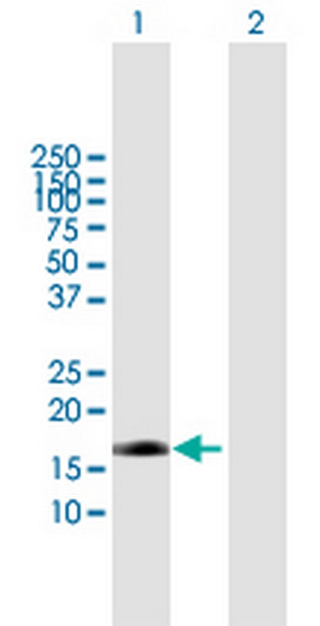 EDN2 Antibody in Western Blot (WB)
