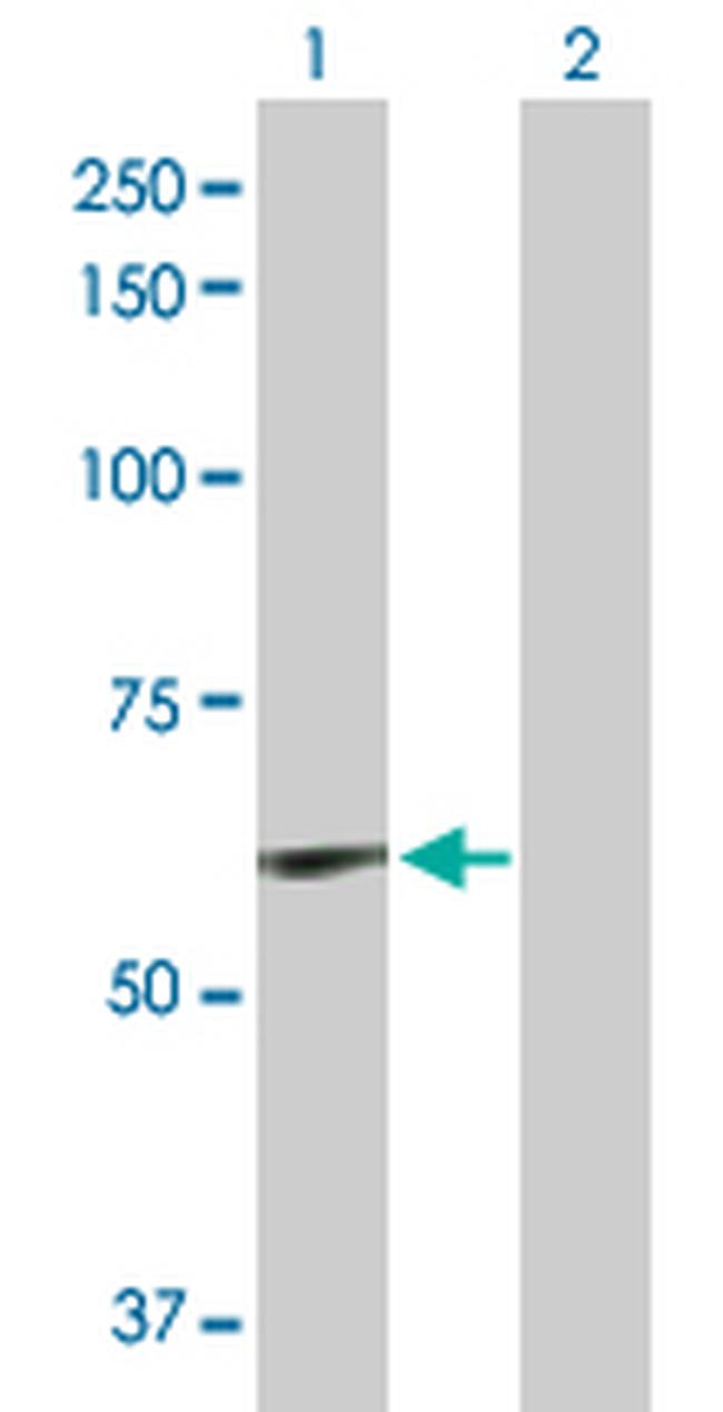 ELN Antibody in Western Blot (WB)