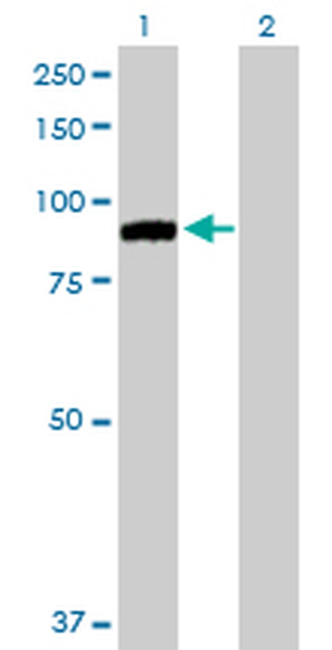 MARK2 Antibody in Western Blot (WB)