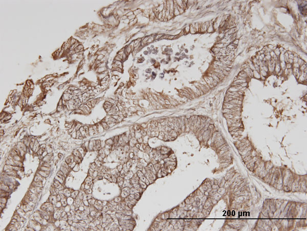 ERBB3 Antibody in Immunohistochemistry (Paraffin) (IHC (P))