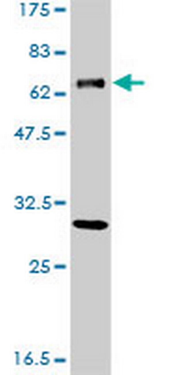 ERCC2 Antibody in Western Blot (WB)