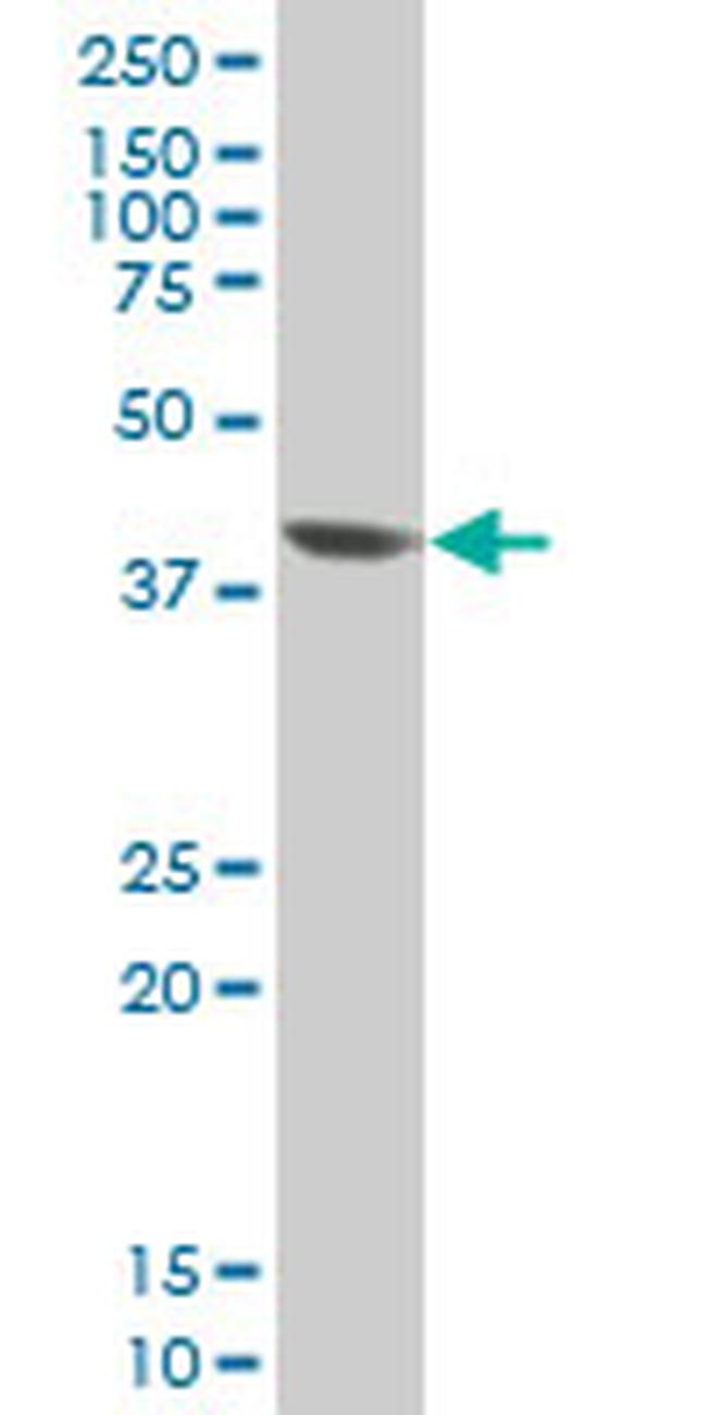 EVX1 Antibody in Western Blot (WB)