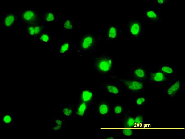 FANCG Antibody in Immunocytochemistry (ICC/IF)