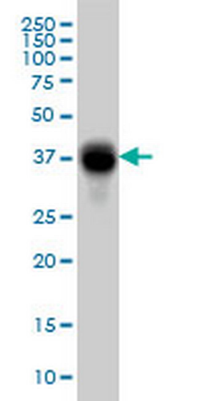 FCGR2B Antibody in Western Blot (WB)