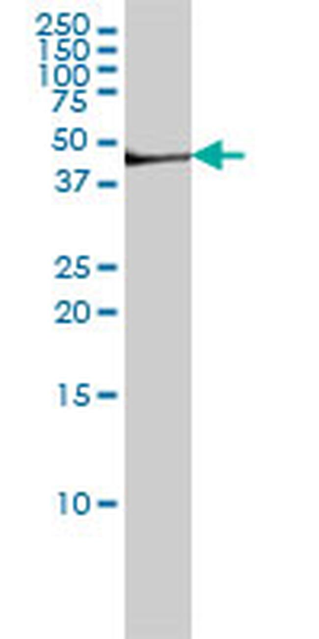 FGG Antibody in Western Blot (WB)