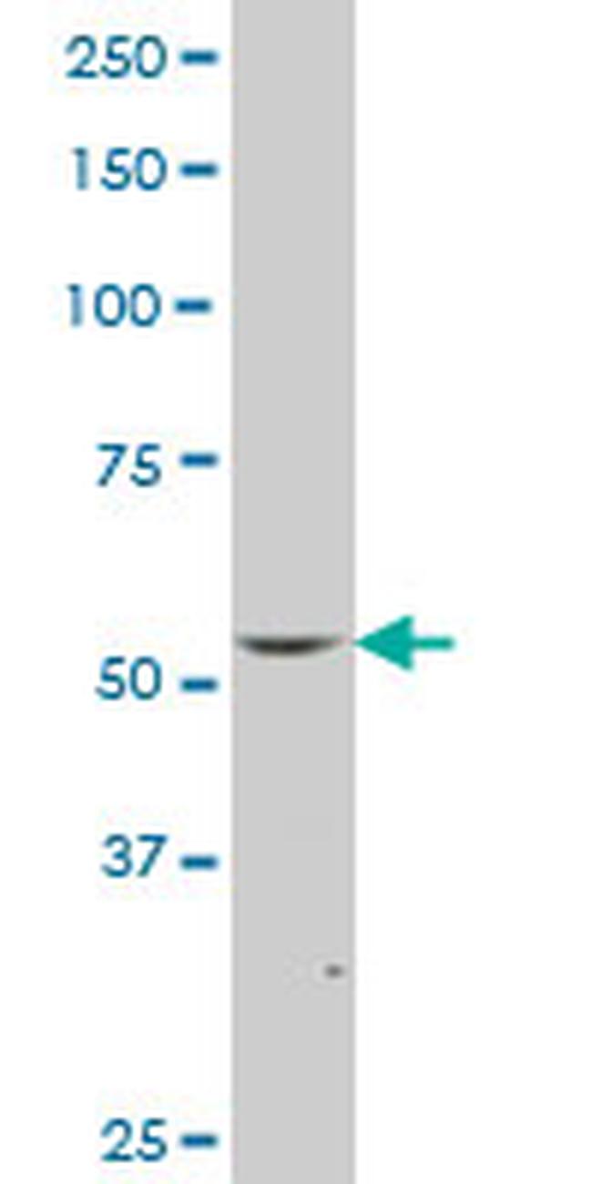 FLI1 Antibody in Western Blot (WB)