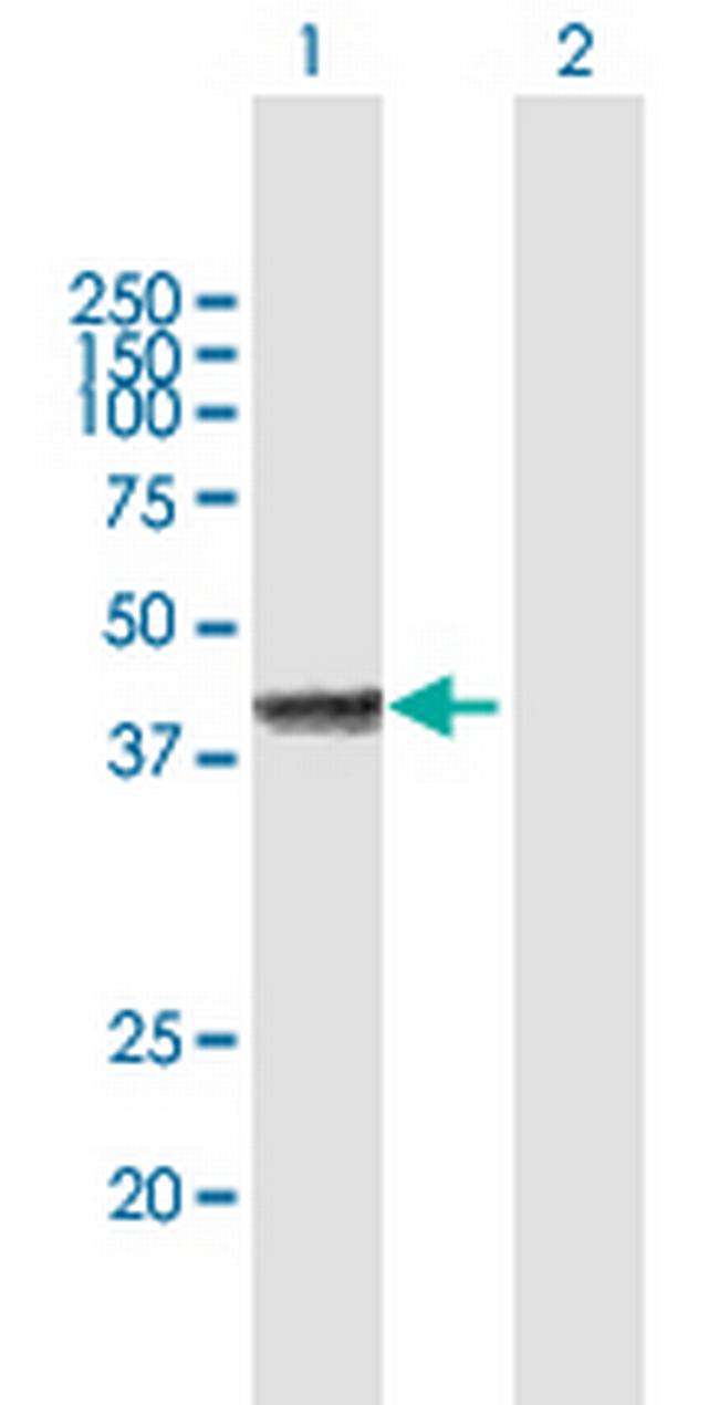 FOSL2 Antibody in Western Blot (WB)