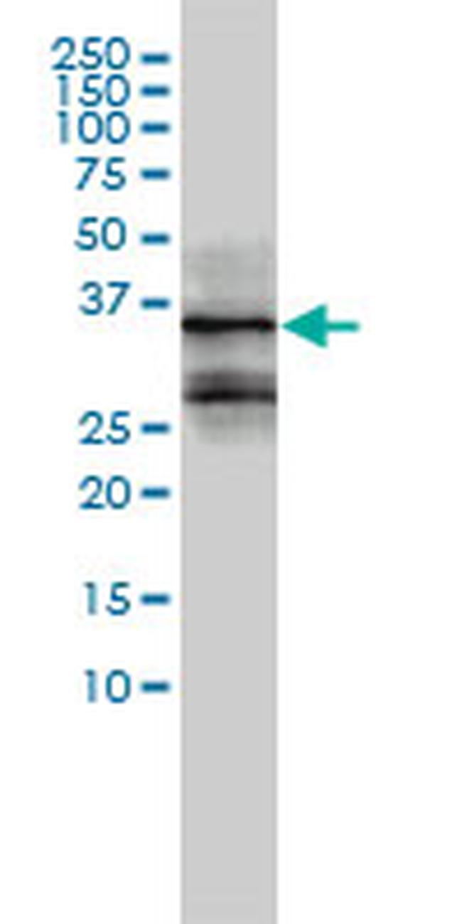 FOSL2 Antibody in Western Blot (WB)