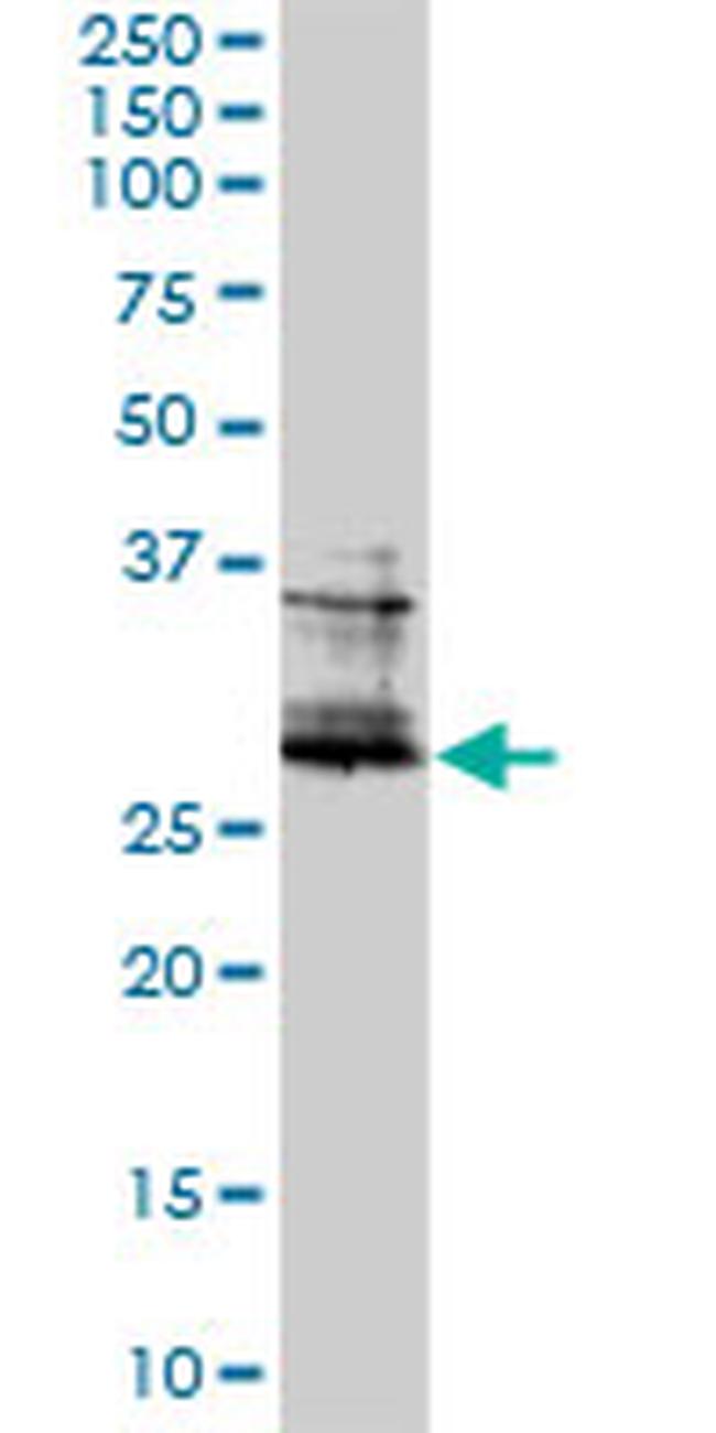 FOSL2 Antibody in Western Blot (WB)