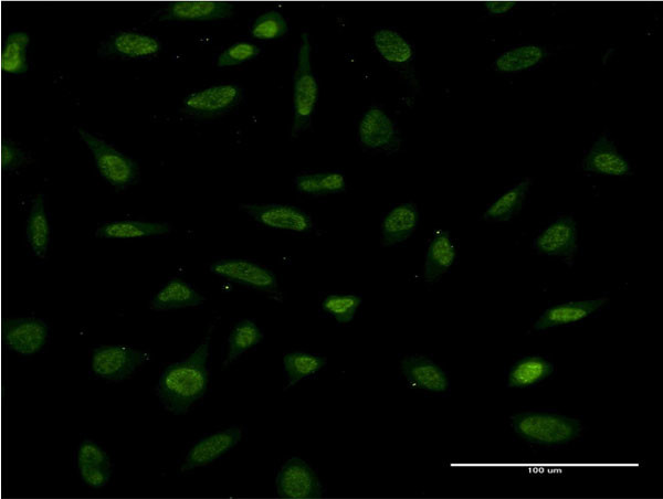 FOSL2 Antibody in Immunocytochemistry (ICC/IF)